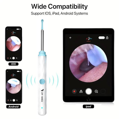 Smart Visual Ear Wax Cleaner – WiFi Otoscope Ear Care Kit for iOS & Android