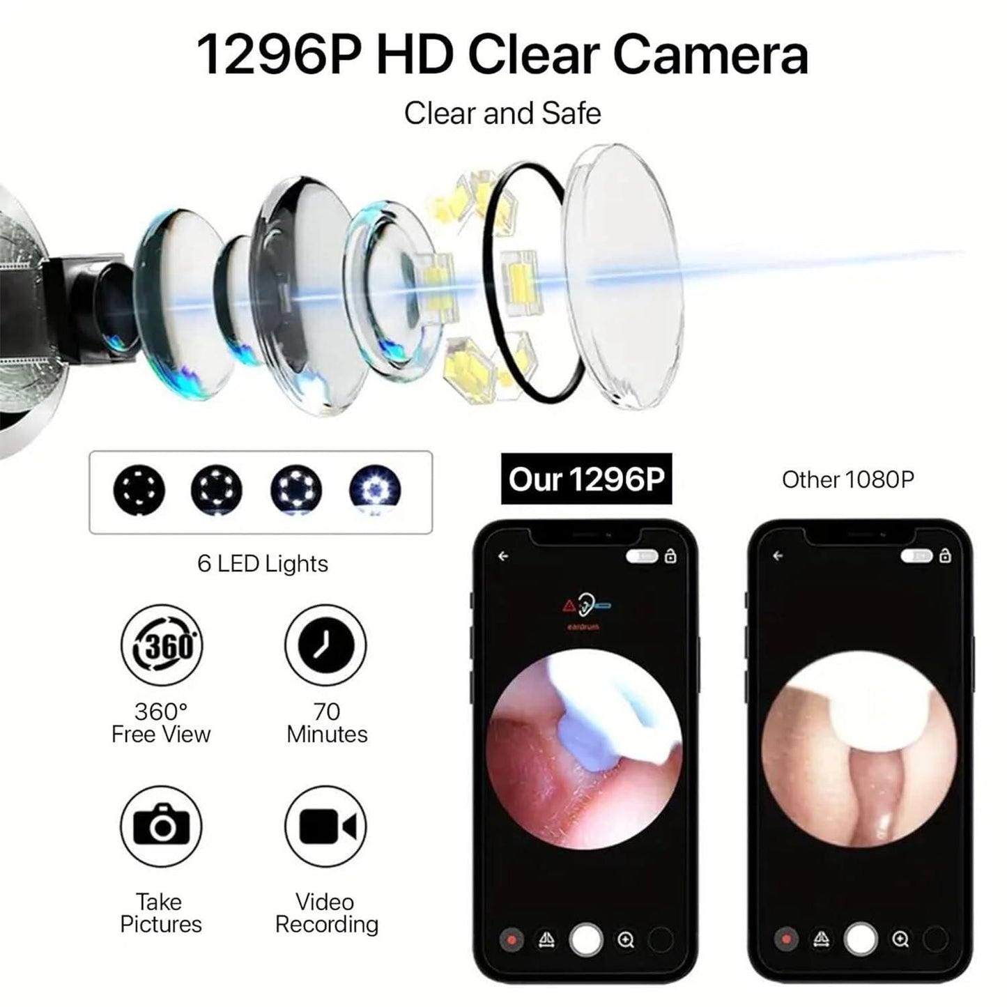 Smart Visual Ear Wax Cleaner – WiFi Otoscope Ear Care Kit for iOS & Android