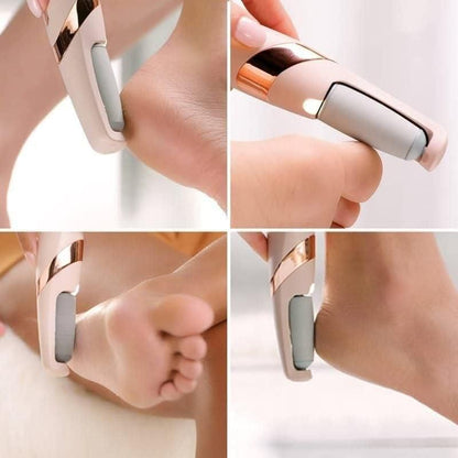 Electronic Cordless Pedicure Callus & Dead Skin Remover Polishing Tool